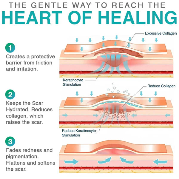 3-in-1 Scar Removal Microneedle Care Patch 💡